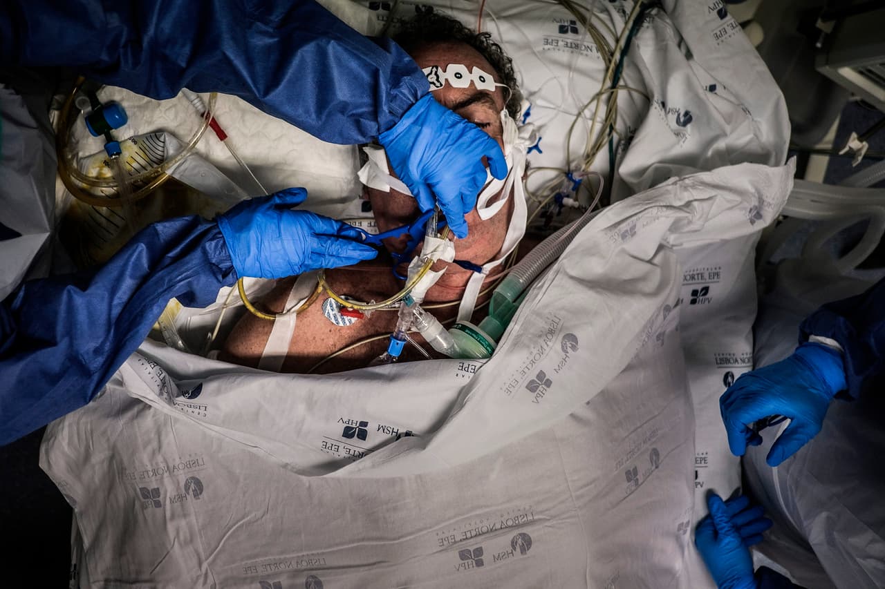 <b>Depender de un respirador.</b> Cuando una paciente de covid-19 se agrava es posible que deba conectarse a un respirador artificial en un unidad de cuidados intensivos. En las zonas más afectadas de EEUU las autoridades han advertido que no hay suficientes de estas máquinas para atender la demanda creciente de pacientes. En la fotografía un enfermo de coronavirus conectado a un respirador en Lisboa, Portugal, 6 de abril.