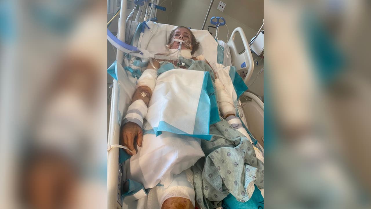 A pesar de las heridas, Rebecca tuvo la fuerza para decirle a los paramédicos el nombre y número de teléfono de su madre.