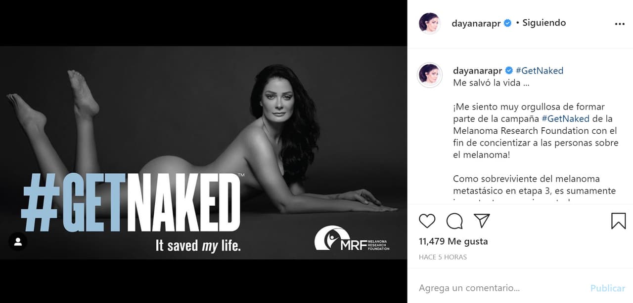 "'Get naked' Me salvó la vida...
<br>¡Me siento muy orgullosa de formar parte de la campaña de la Melanoma Research Foundation con el fin de
<b>concientizar a las personas sobre el melanoma</b>!".
<br>