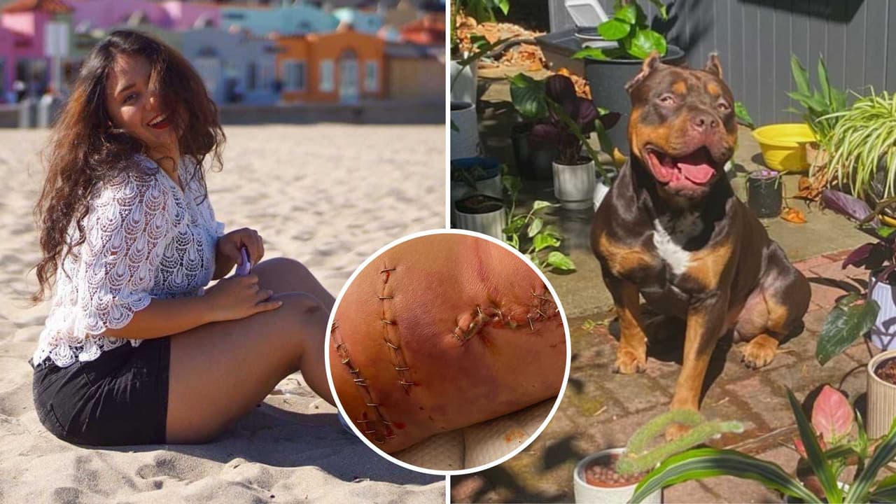 <b>María Paula Peña, de 27 años</b>, llegó a Estados Unidos hace seis años y fue atacada por sus perros de raza pitbull el pasado 24 de junio en Concord, California.