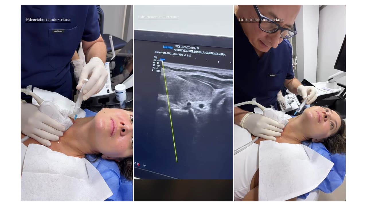 Así fue el procedimiento médico al que se sometió la modelo colombiana.