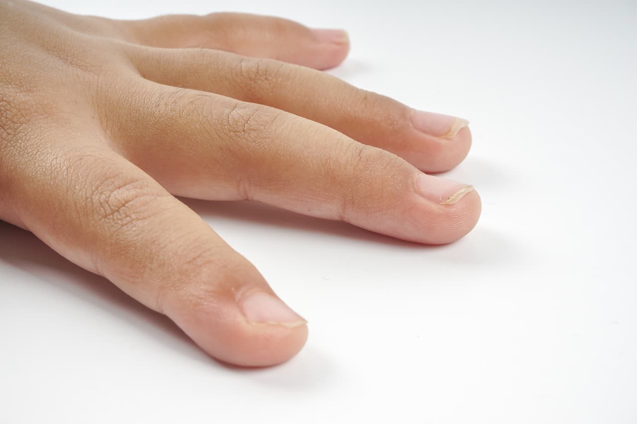 Si tus uñas lucen pálidas y sin brillo puede ser síntoma de anemia y deberás consultar al médico, también es importante mejorar tu dieta consumiendo alimentos ricos en hierro.