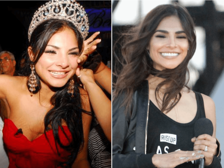 Alejandra nunca ha ocultado que se modificó la dentadura: "Solo me he operado el busto y me hice los dientes", dijo para People en Español el pasado 2 de agosto.