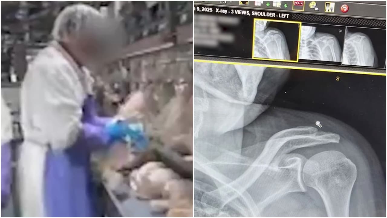 “Enganchábamos hasta 39 pollos por minuto": trabajador hispano denuncia lesión que terminó en cirugía