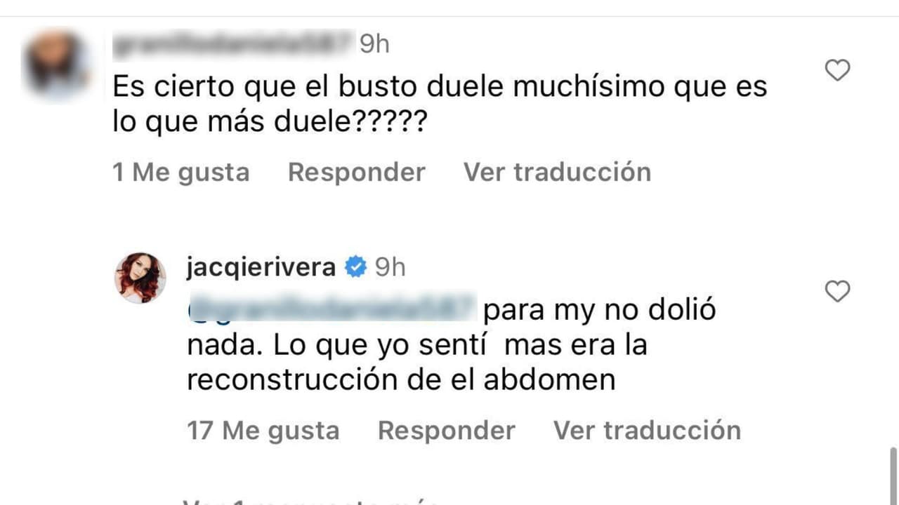 Jacqie Rivera también respondió dudas de sus seguidores respecto a la operación.