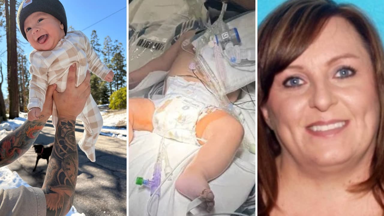 “Es hermoso y dulce”: Bebé de tres meses pierde la mitad de su cráneo tras abuso de su niñera en el Valle Central