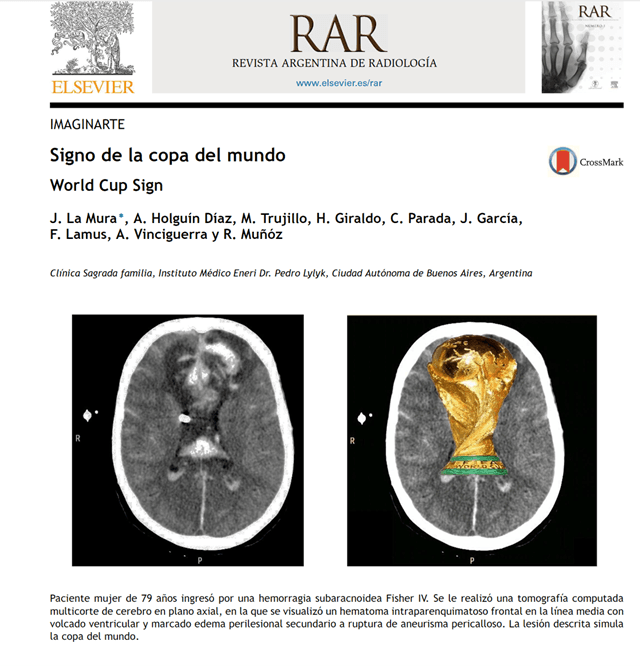 Holguín Díaz firmó este estudio comparativo de una hemorragia y la copa mundial de futbol.
<br>