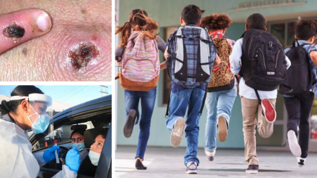 Escuelas de Los Ángeles están preparadas para recibir a más de 400,000 estudiantes durante el regreso a clases. En medio de brotes de covid-19 y la viruela del mono, muchos padres manifiestan preocupación por posibles infecciones. Un doctor aclara dudas y da recomendaciones para evitar contagios.