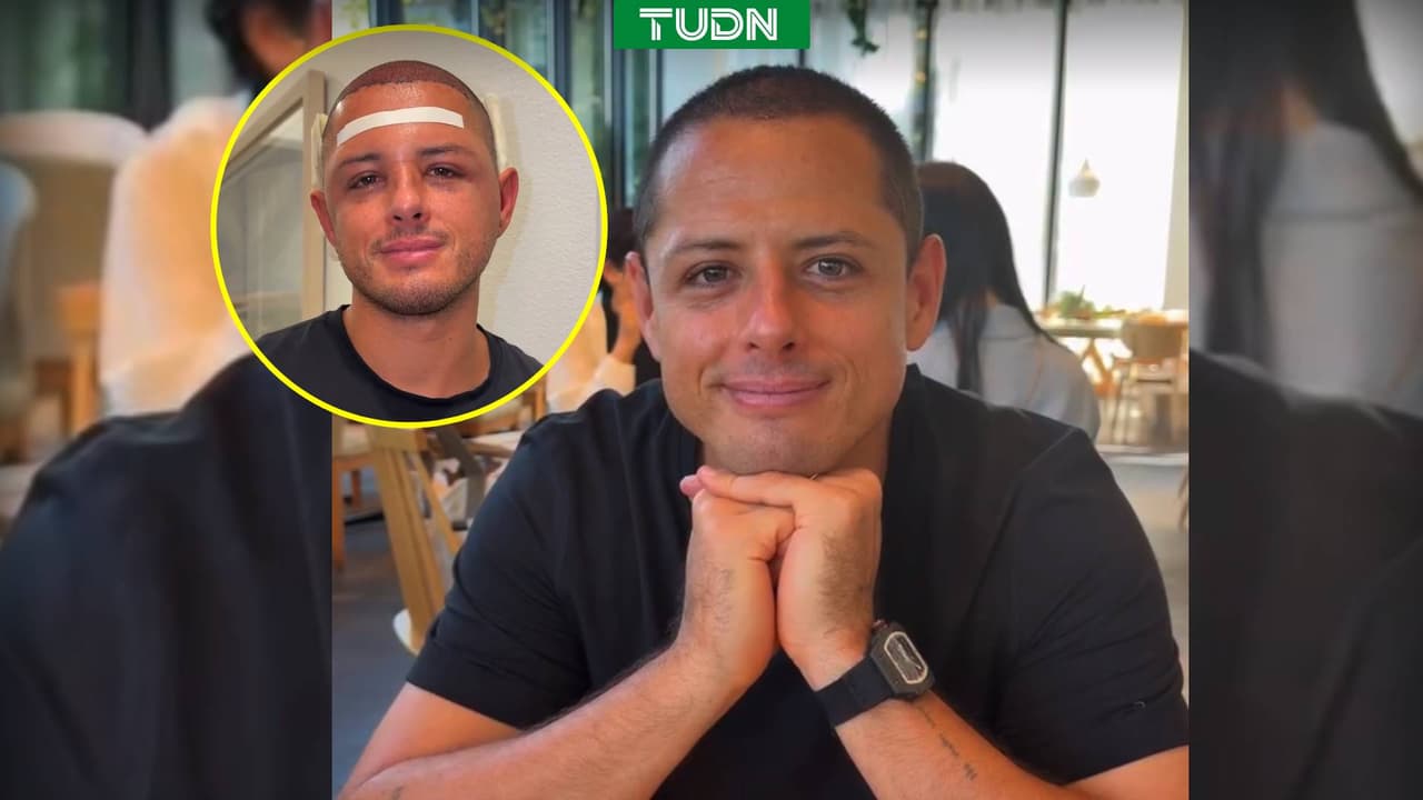 Chicharito Hernández muestra detalles de su injerto de cabello