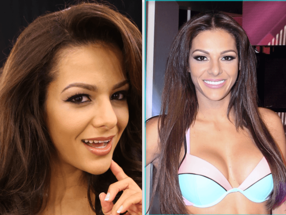 Definitivamente el rostro de Nathalia luce muy distinto con sus dientes nuevos.