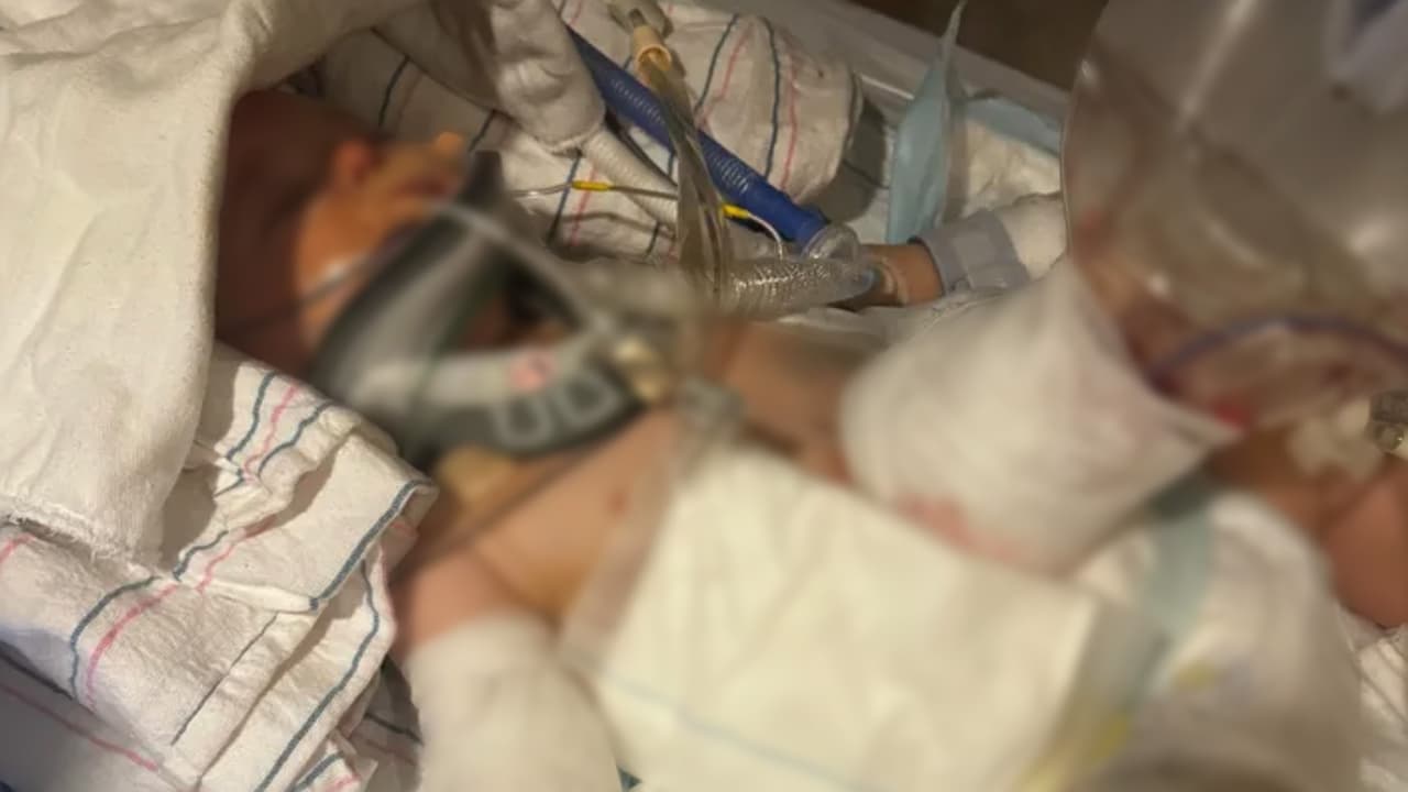 Jaxson se encuentra hospitalizado en condición estable, pero crítica.