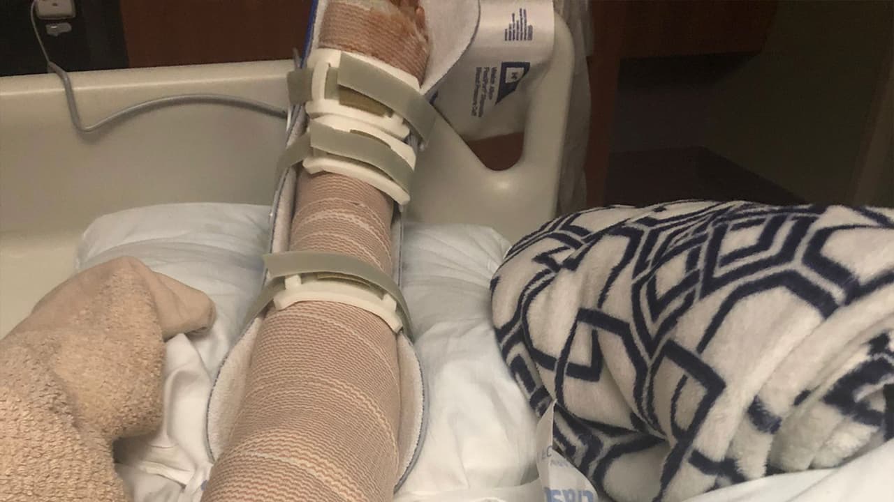 "Por dentro es un dolor muscular intenso y por fuera es un ardor tremendo. Se siente que te quemen en vida", le dijo esta madre de cuatro hijos a
<a href="https://www.univision.com/local/houston-kxln/">Univision 45</a>.