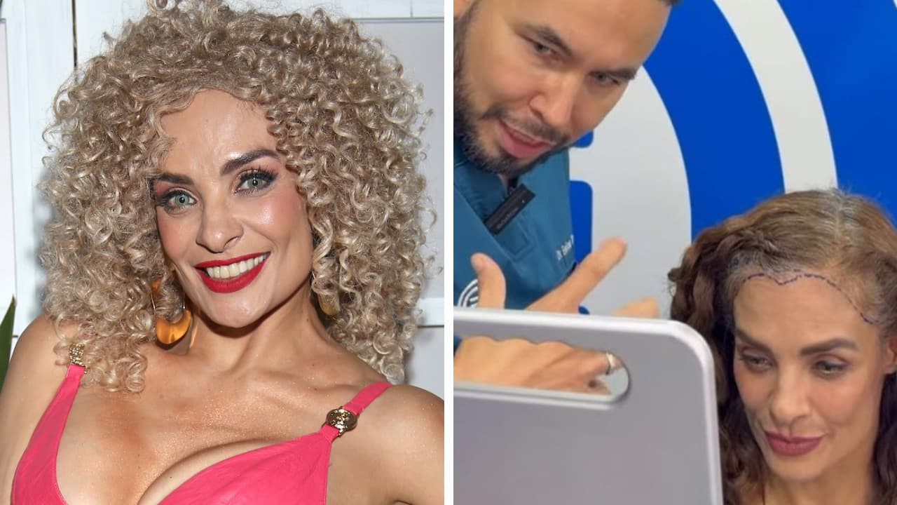 Actriz de 'María de Todos los Ángeles' se somete a un injerto capilar tras padecer alopecia por tracción