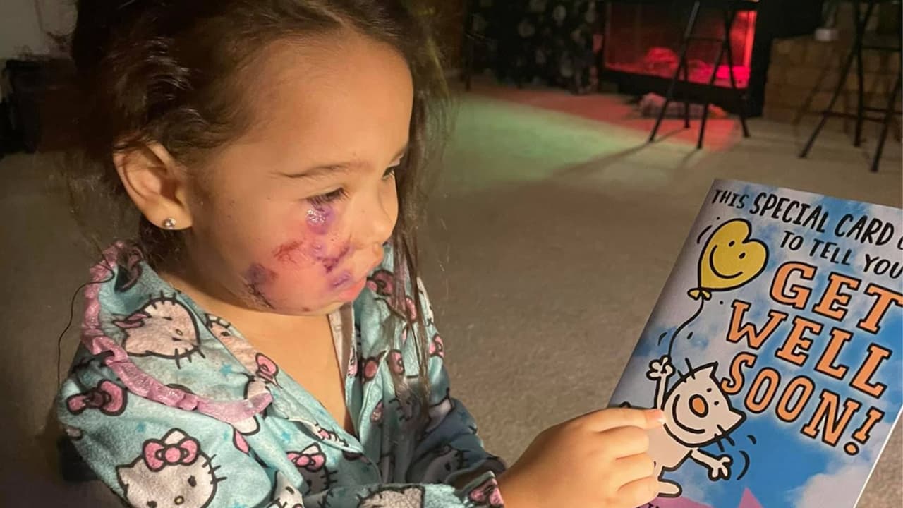 Robin Waldroup, de 3 años, se encontraba con sus padres en un restaurante en Old Town Spring cuando el perro la atacó.