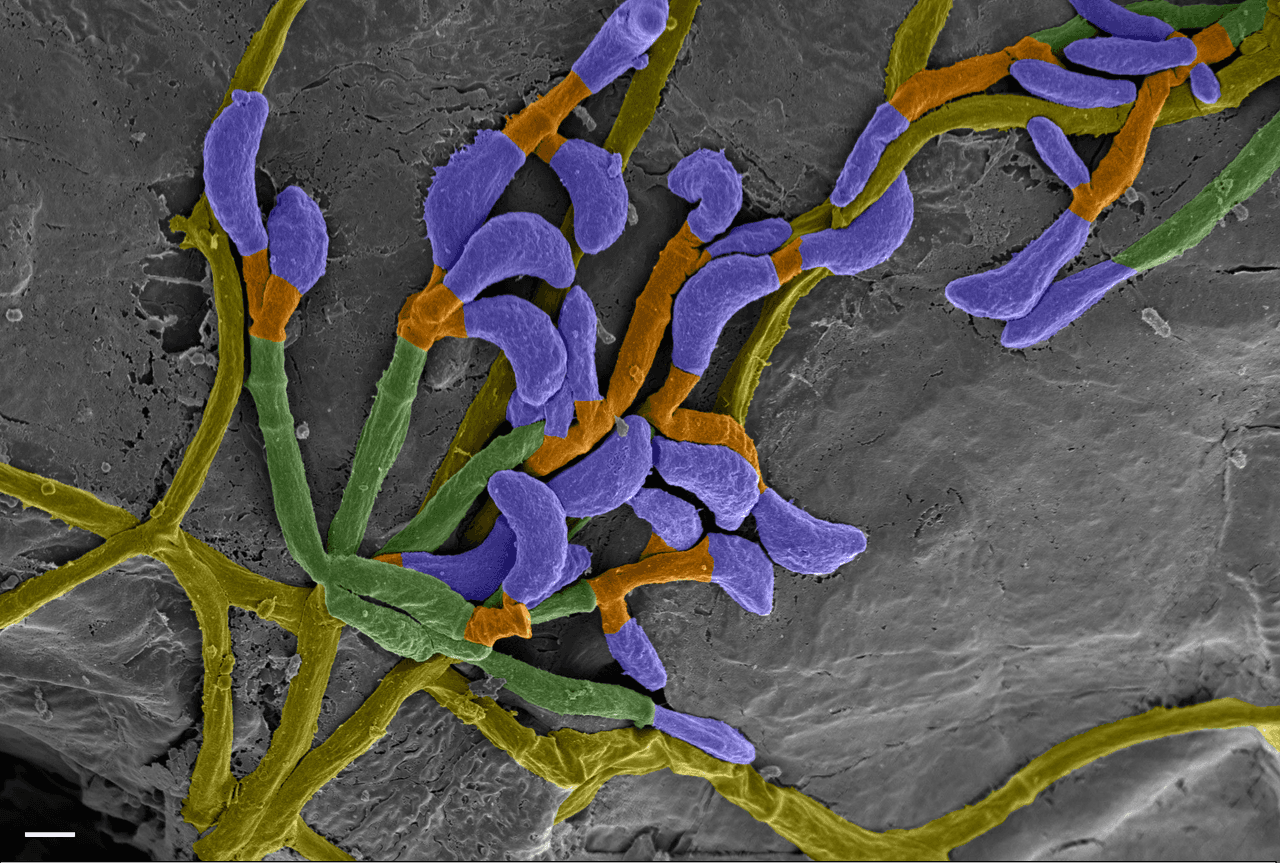 Pseudogymnoascus destructans