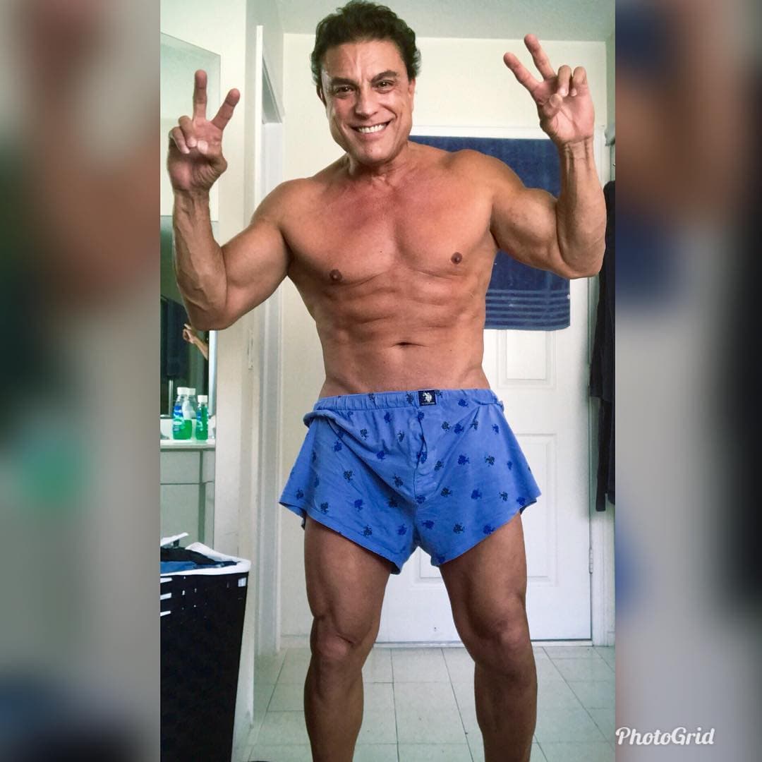 Con esta foto postoperatoria, el actor demuestra que está en excelente condición. "Yo no me quito. Volví a ser yo", escribió junto a esta foto.