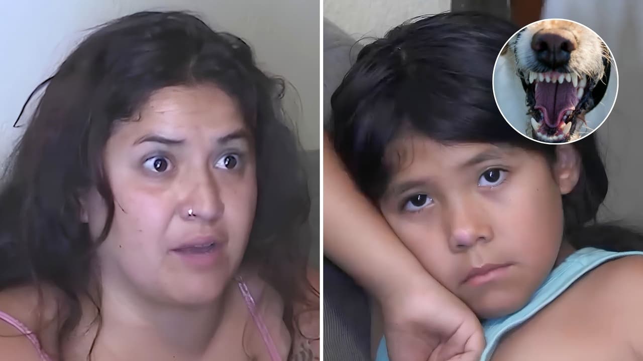 Niña de 8 años salva a su hermana pequeña de un ataque de perro y ella queda con mordeduras en la cabeza y el cuerpo