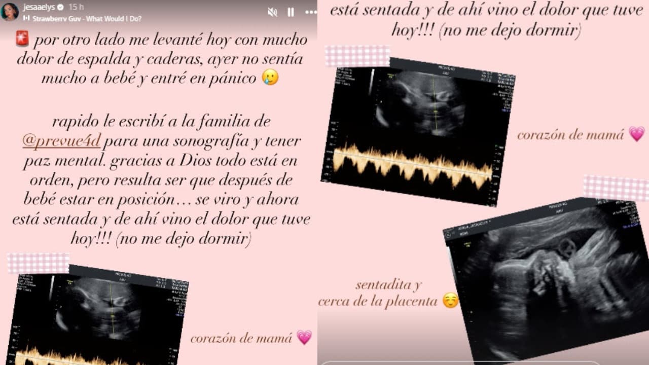 Jesaaelys Ayala sufrió gran susto en la recta final de su embarazo.