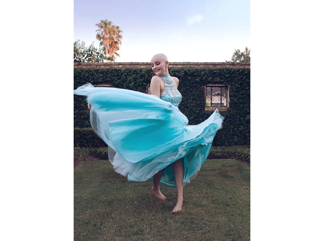 "Me sentí libre sin la peluca"