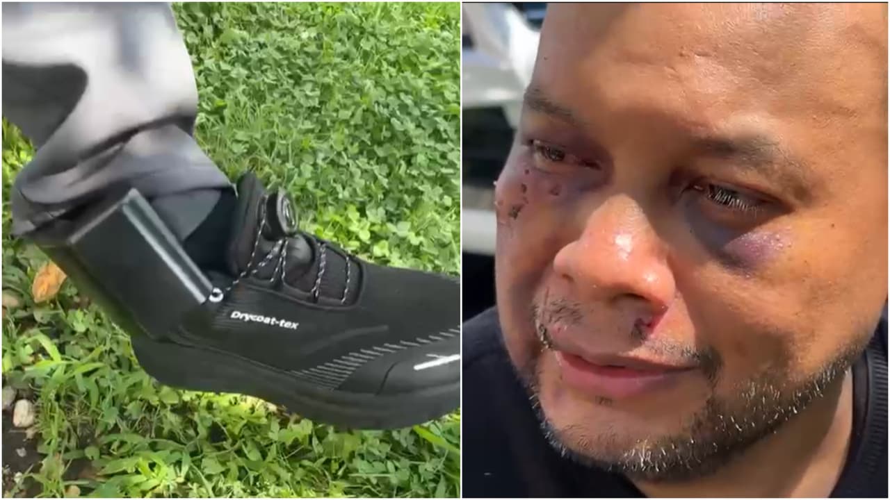 “Perdí el conocimiento”: padre mexicano que denunció agresión de agentes de ICE pasó 3 días hospitalizado