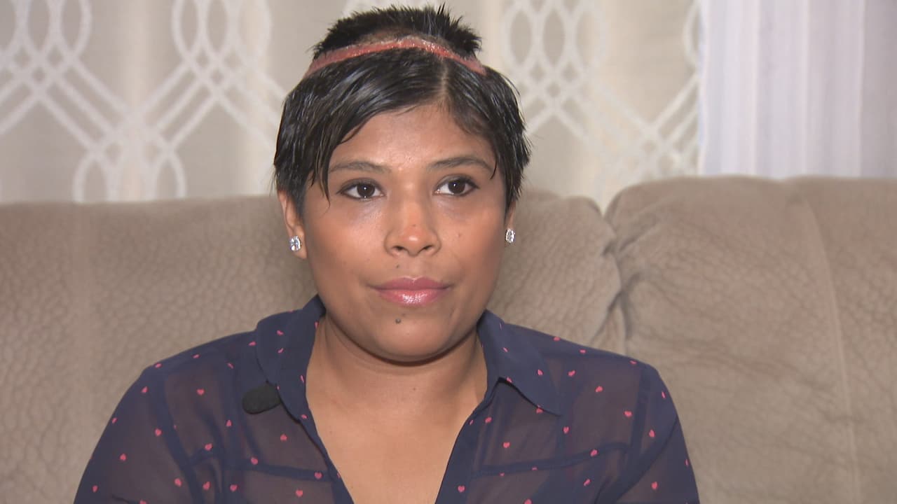 Fue al salón de belleza a arreglarse el cabello y terminó con quemaduras de tercer grado