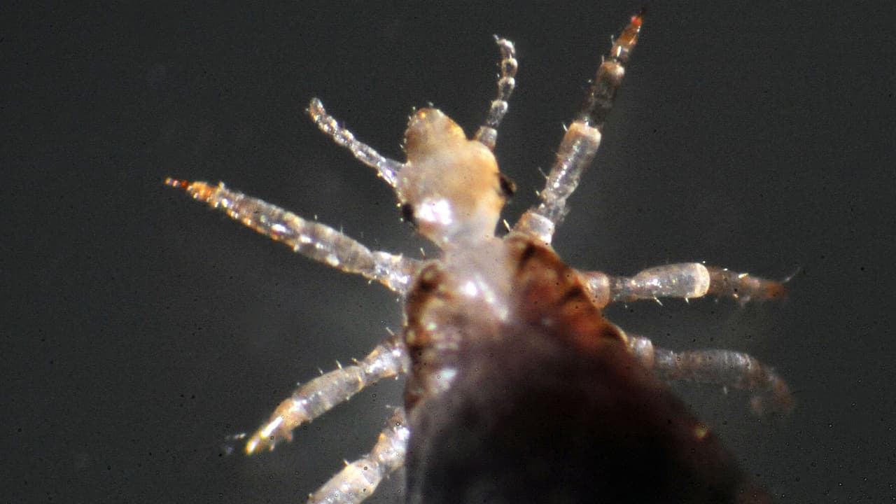 Los piojos se arrastran, no pueden saltar ni volar, aunque sí se mueven muy rápido y se reproducen rápidamente, de acuerdo con información de los CDC en su página web.