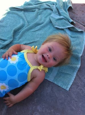 Ellos buscan refutar los temores y prejuicios que muchas veces son asociados con el trastorno genético.