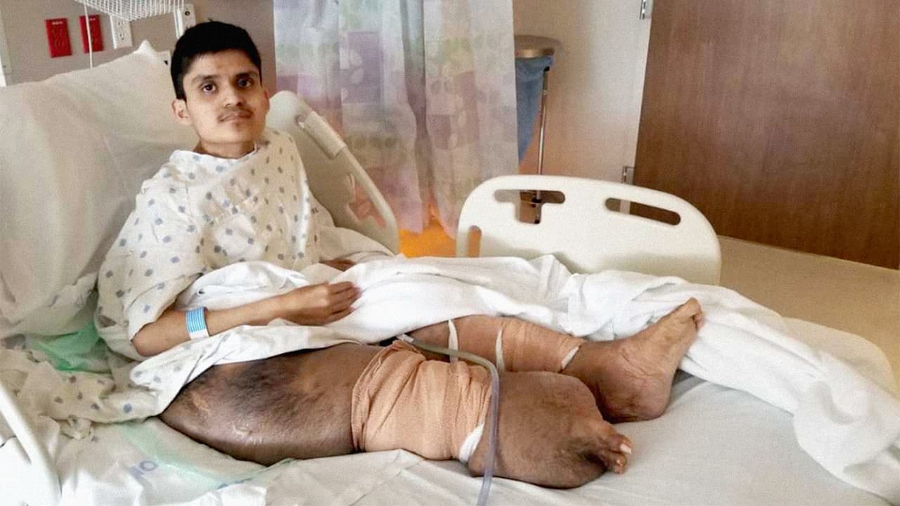 Pablo Sánchez, de 24 años, padece de
<b>neurofibromatosis.</b>