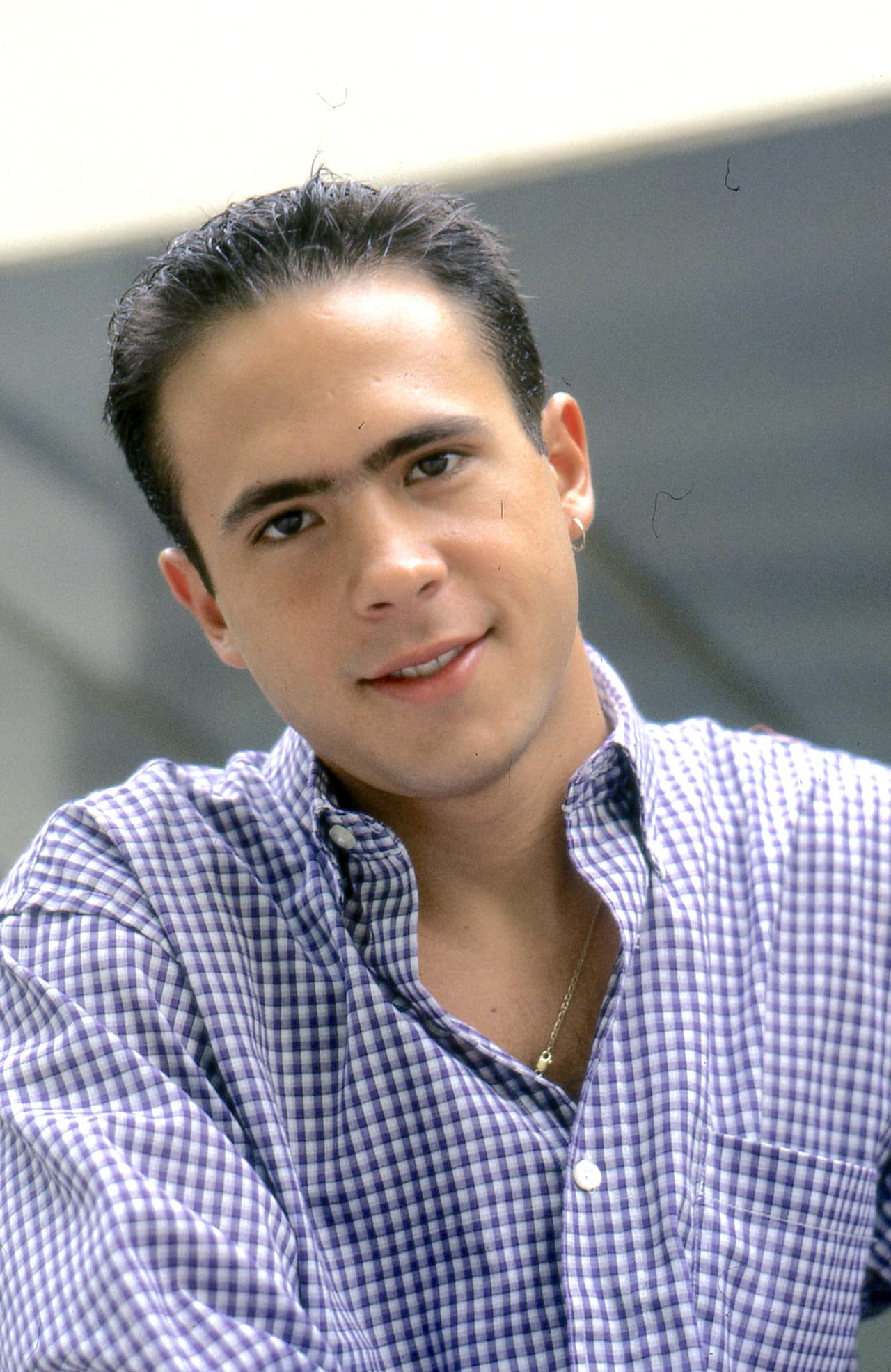 El actor comenzó a
<b>perder cabello a los 20 años</b> y a los 24 se sometió a una cirugía para recuperar el cabello.
<br>