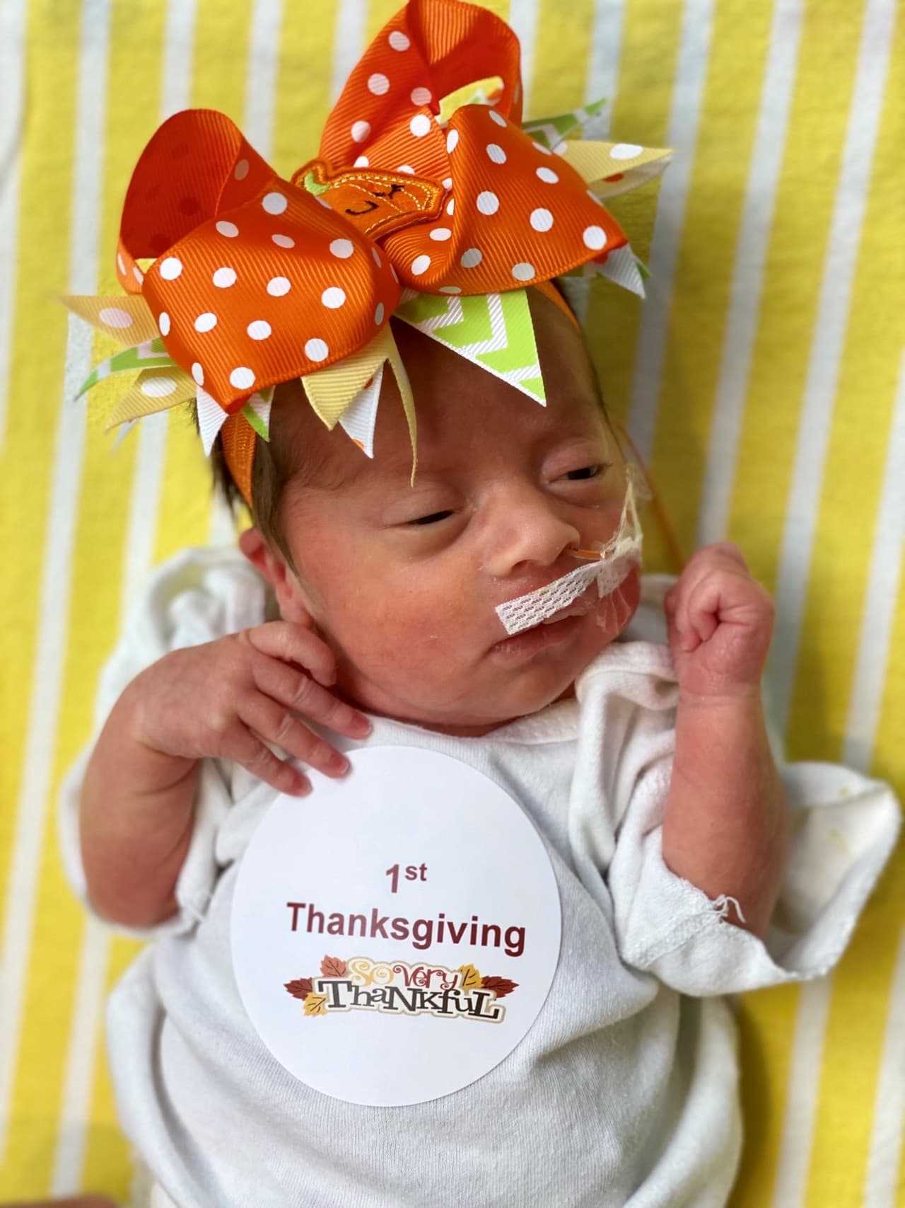 La bebé Rachelle modela un enorme moño en tonos naranjas, amarillos y verdes. Luce linda para su primer
<a href="https://www.univision.com/local/dallas-kuvn/sigue-estas-recomendaciones-para-evitar-contagios-con-coronavirus-durante-thanksgiving-video">Día de Acción de Gracia. </a>