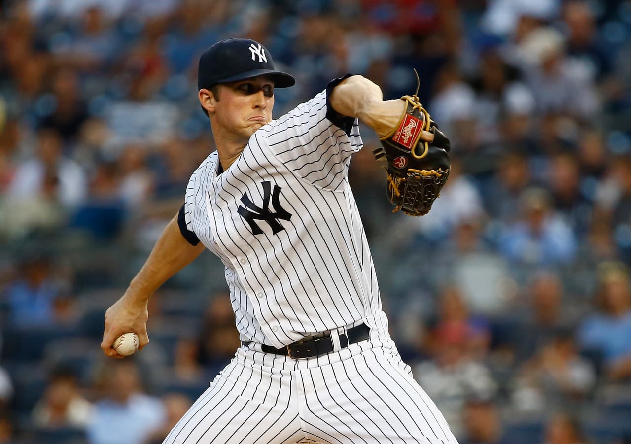 Pitcher de los Yankees recibe pelotazo en el rostro