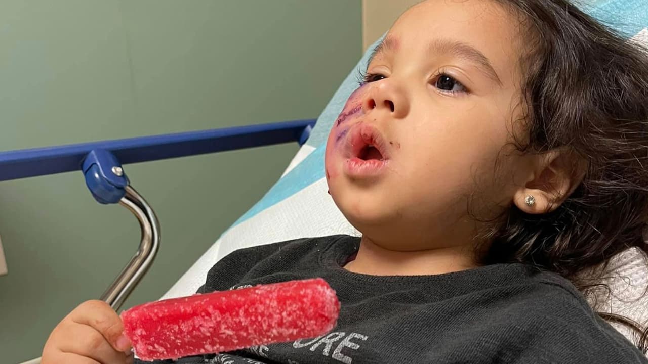 La madre narra que el animal estaba dentro del establecimiento y atacó a su hija. Añade que los dueños del animal presenciaron los hechos y no hicieron nada, salieron corriendo y huyeron del lugar.