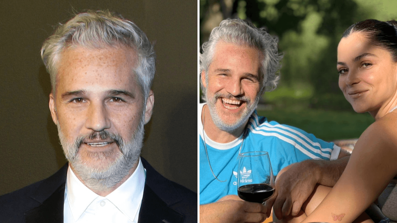 Juan Pablo Medina confirma la ruptura de Paulina Dávila a 2 años de la amputación de su pierna