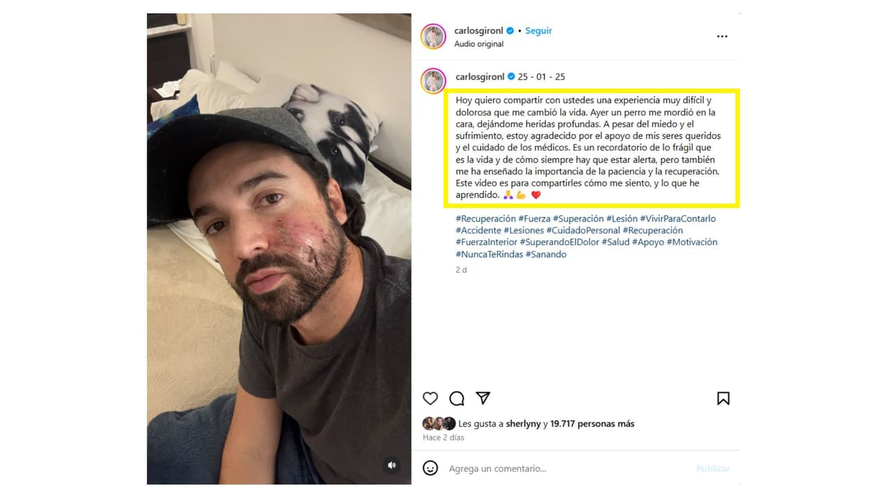 El actor fue atacado por un perro en el rostro.