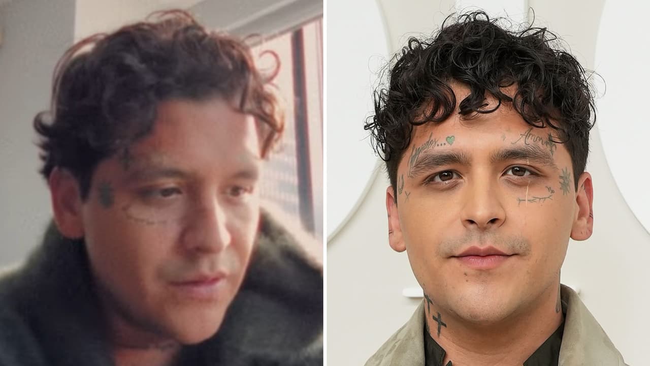 Nodal confiesa sentir nervios porque se someterá a procedimiento estético: “Deséenme suerte”