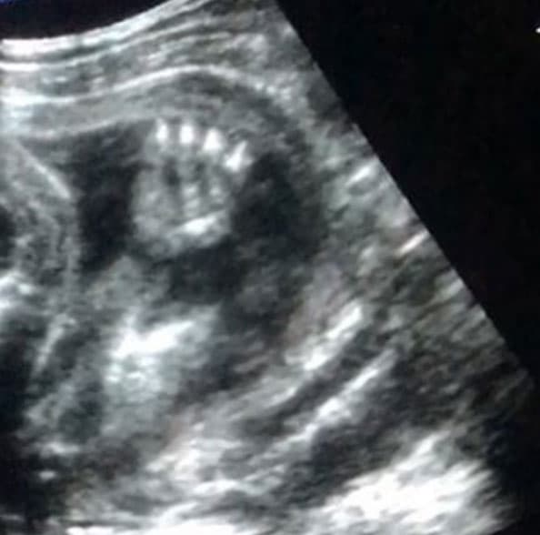 También compartió con sus seguidores el ultrasonido del bebé que esperan.