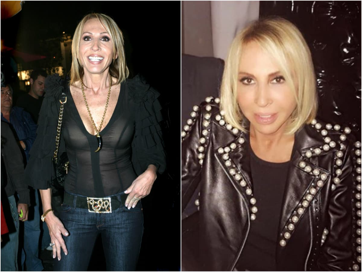 También confirmó que en su natal Perú se sometió a un tratamiento de hilos rusos.