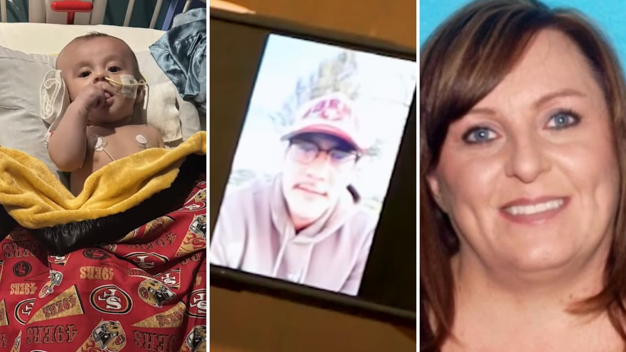 Habla papá del bebé que perdió la mitad de su cráneo por supuesto abuso de su niñera