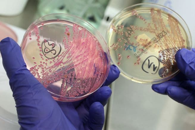 Investigan el origen de un nuevo brote de E. coli que ya afecta a 5 estados