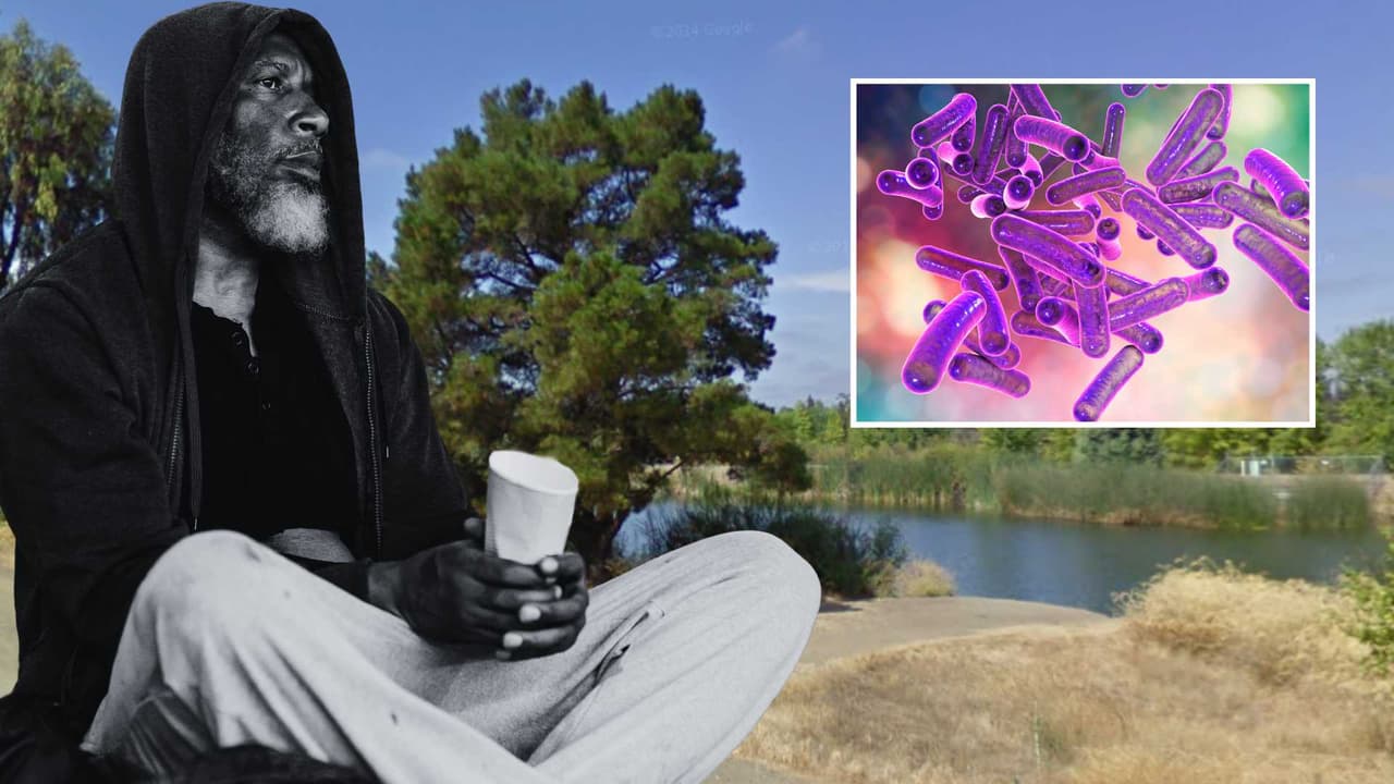 Reportan 9 infecciones de Shigela en personas sin hogar en el condado de Santa Clara