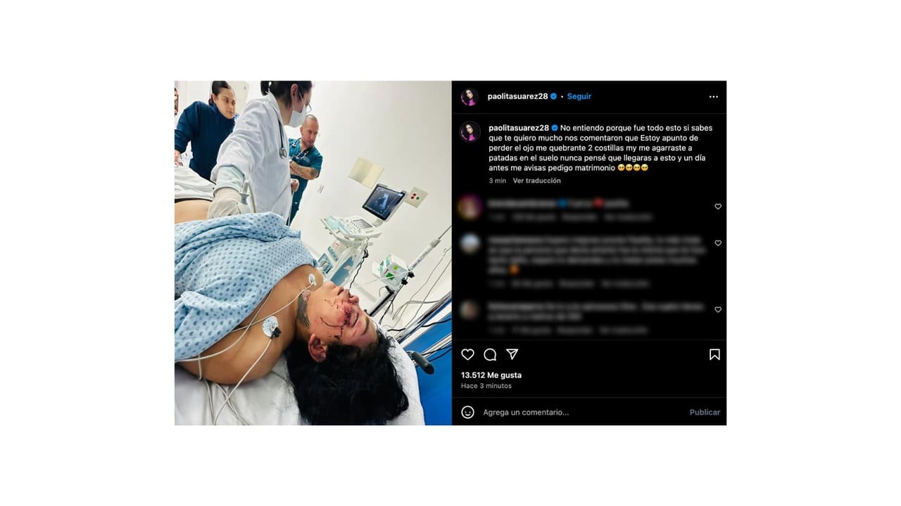 Paola Suárez señala a su novio de haberla golpeado.