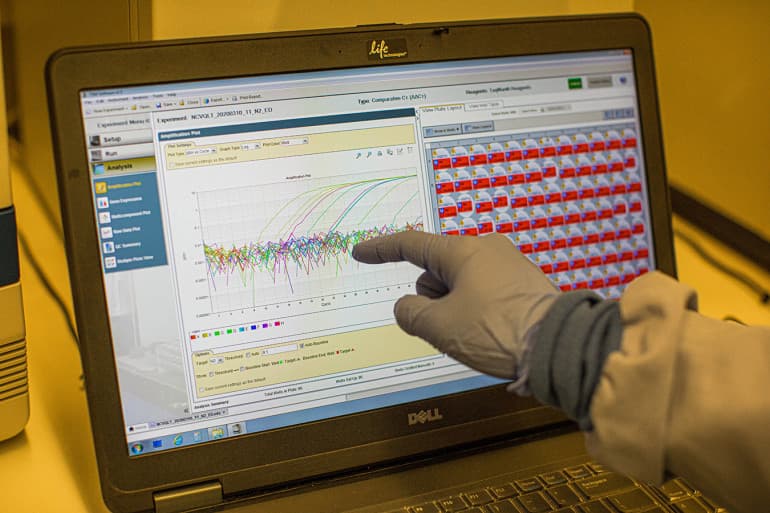Los colores muestran en pantalla las pruebas de reacción en cadena de la polimerasa (PCR) en tiempo real. Los picos indican muestras de pacientes positivos para el virus que causa covid-19.