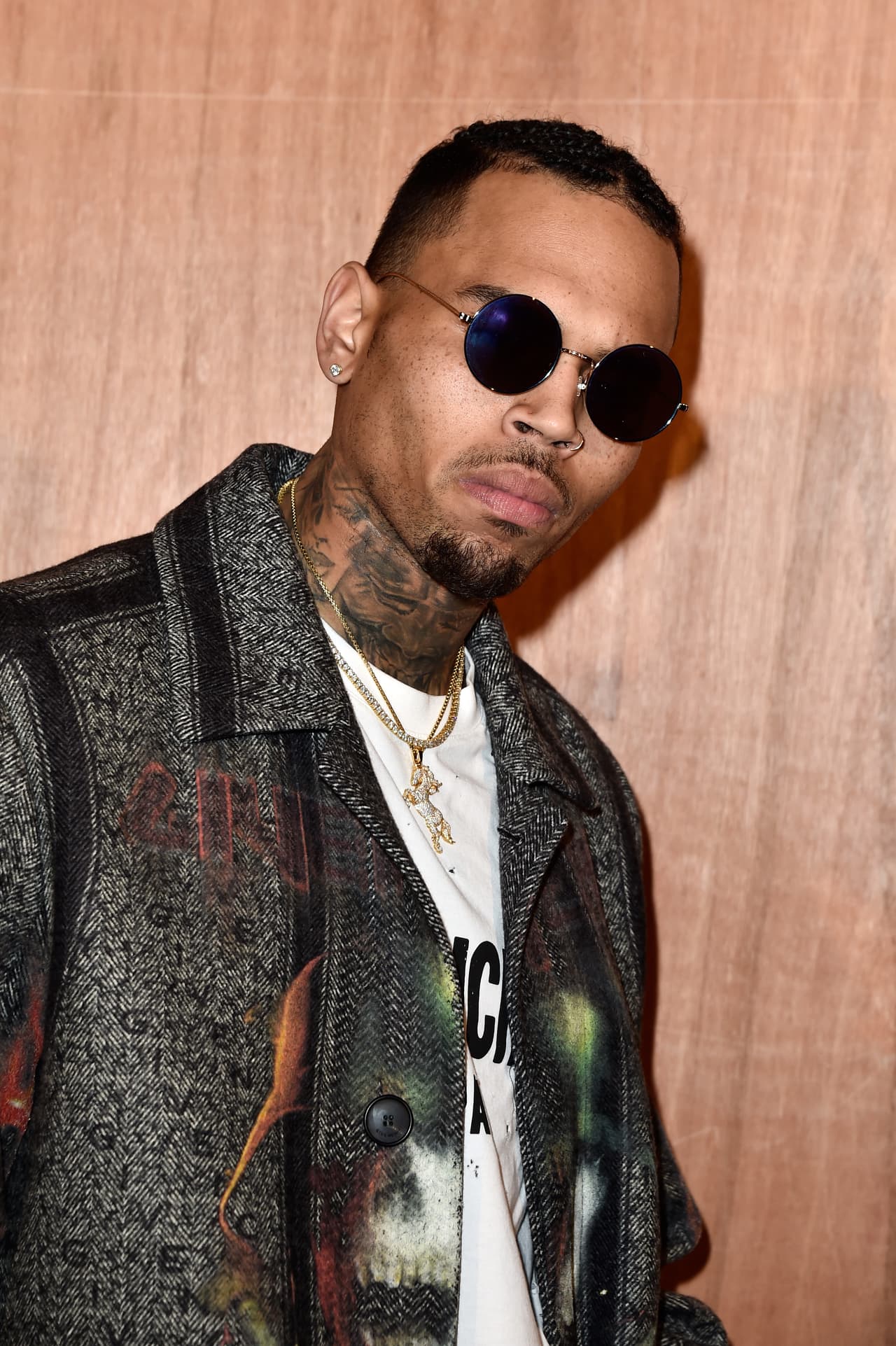 Por si fuera poco, era tal su depresión, que no dormíoa, no comía y sólo se drogaba. Todo esto lo dijo en su documental titulado 'Welcome To My Life'.