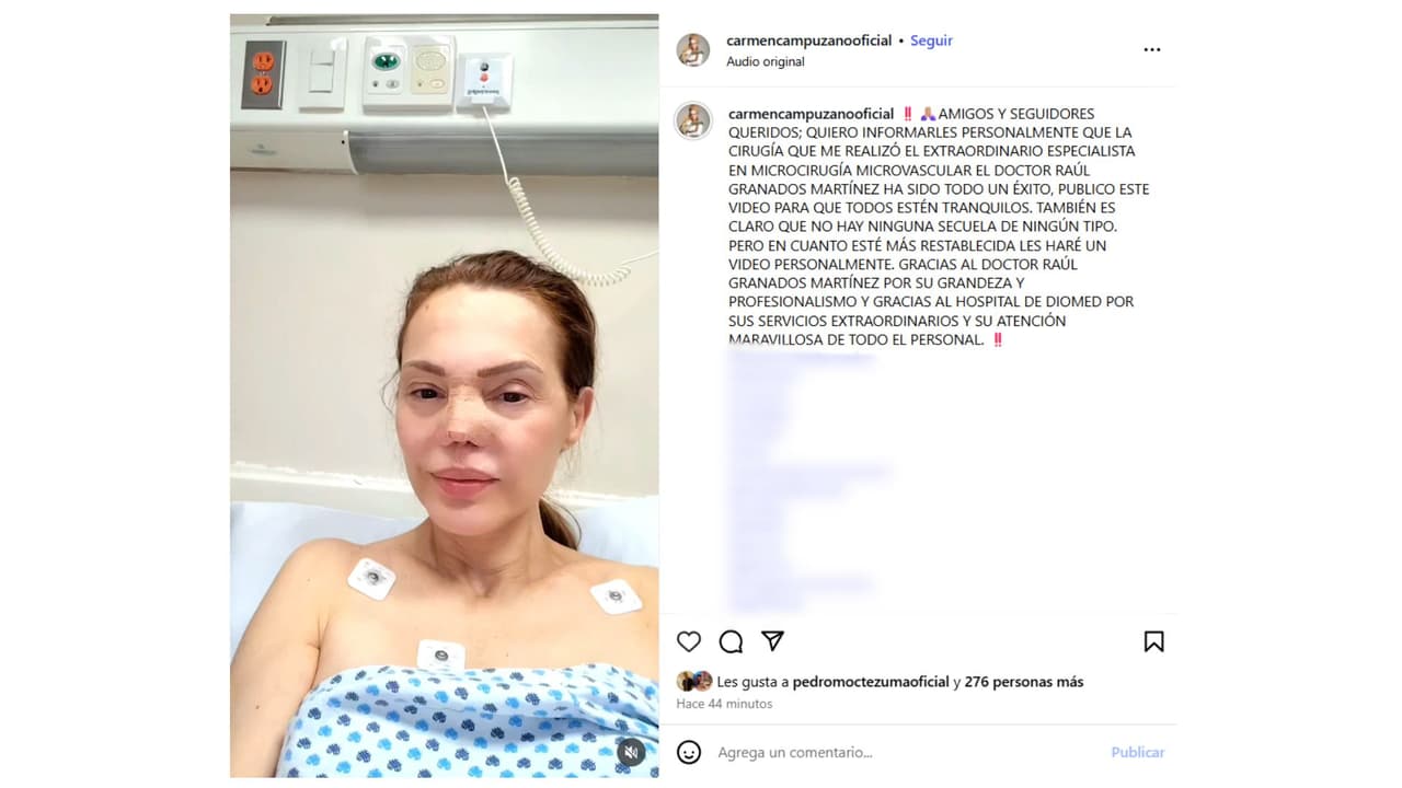 Así reapareció Carmen Campuzano tras someterse a nueva cirugía en la nariz.