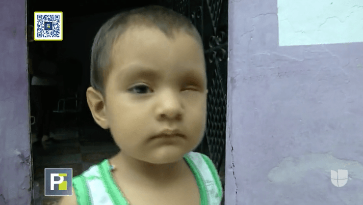 El pequeño Herminio, de solo dos años, nació librando una dura batalla, que conoció hasta que un día su madre lo llevó a un hospital.