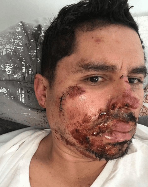 <b>Larry Hernández</b>: el 29 de diciembre del 2017, el cantante mexicano salió a correr bicicleta y tuvo un aparatoso accidente que hasta el día de hoy le ha impedido ofrecer conciertos y trabajar. Sin embargo, su salud está bien y se recupera para volver a los escenarios.
<br>