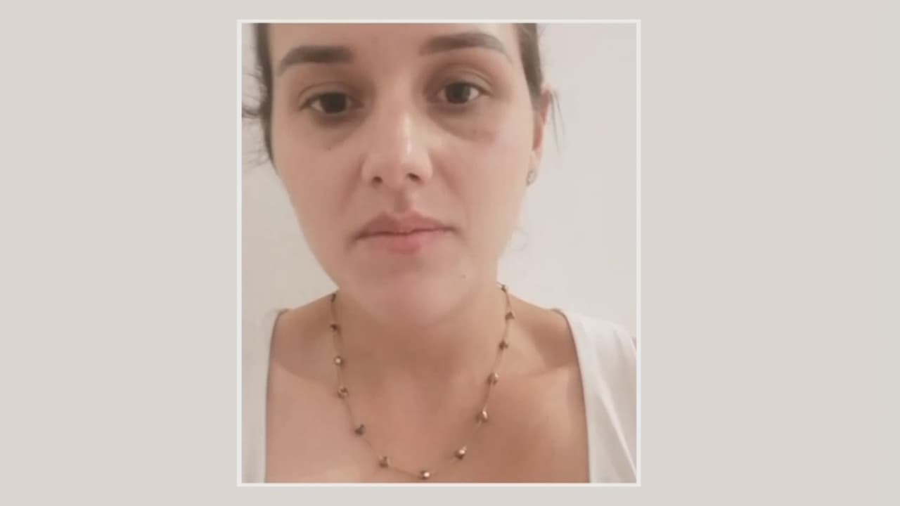 Después del ataque, ella cuenta que perdió el conocimiento y cuando volvió en sí pidió ayuda al 911. La operadora se mantuvo en la línea con ella hasta que llegó un policía.
<br>