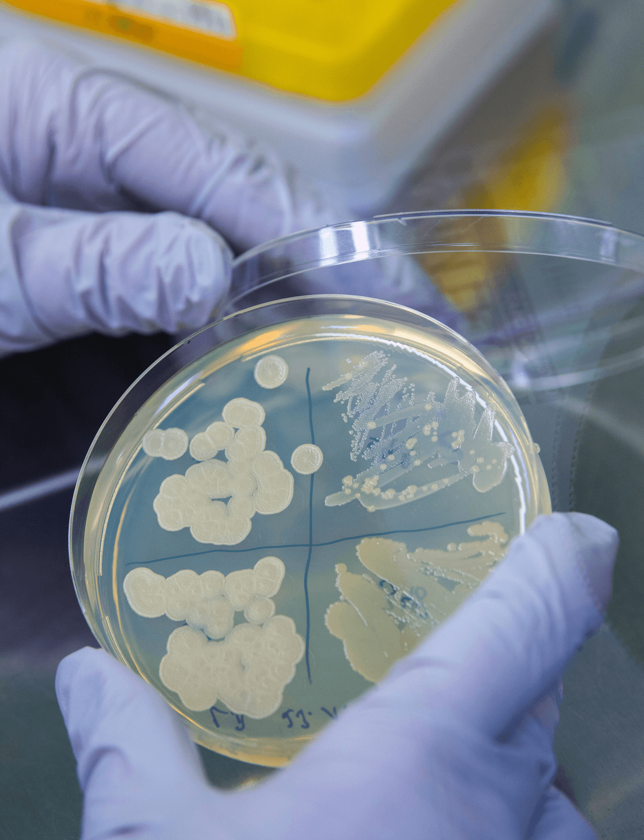 El brote de E. coli se extiende a Illinois, y a otros nueve estados