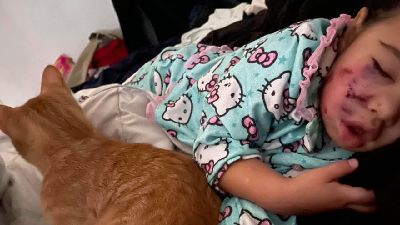 Gordon-Waldroup dijo que la familia acababa de llegar al Loose Caboose, esperaban en la fila para ordenar su comida cuando en cuestión de segundos, la pequeña se encontró de frente con el animal que la mordió en la cara.