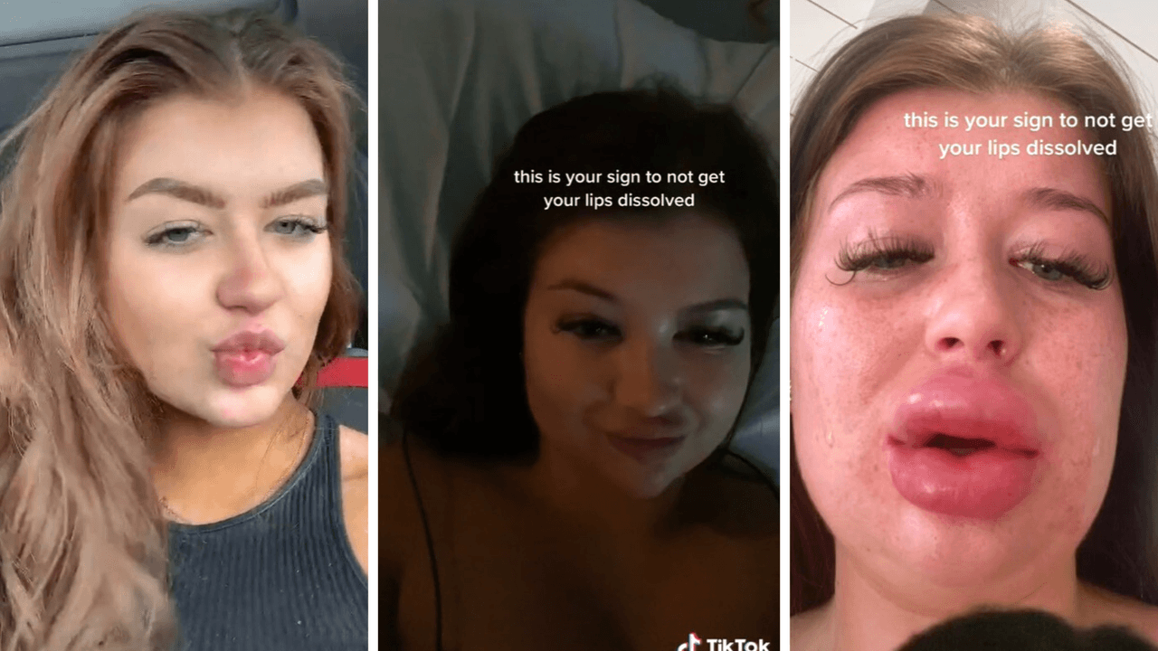 Así lucía la joven antes de la cirugía y después